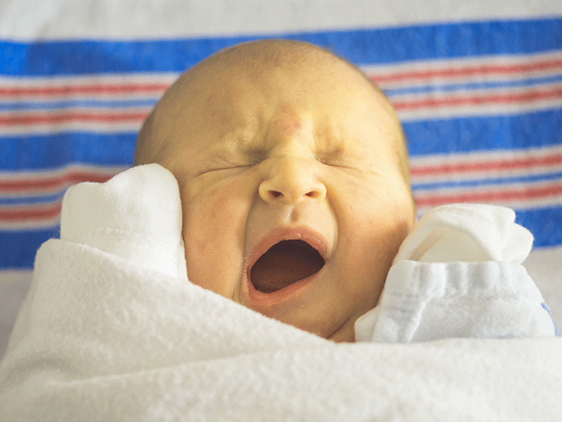 ittero del neonato